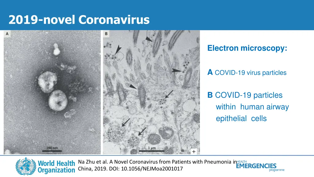 2019 novel coronavirus