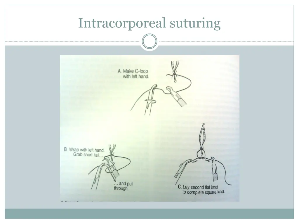 intracorporeal suturing 1