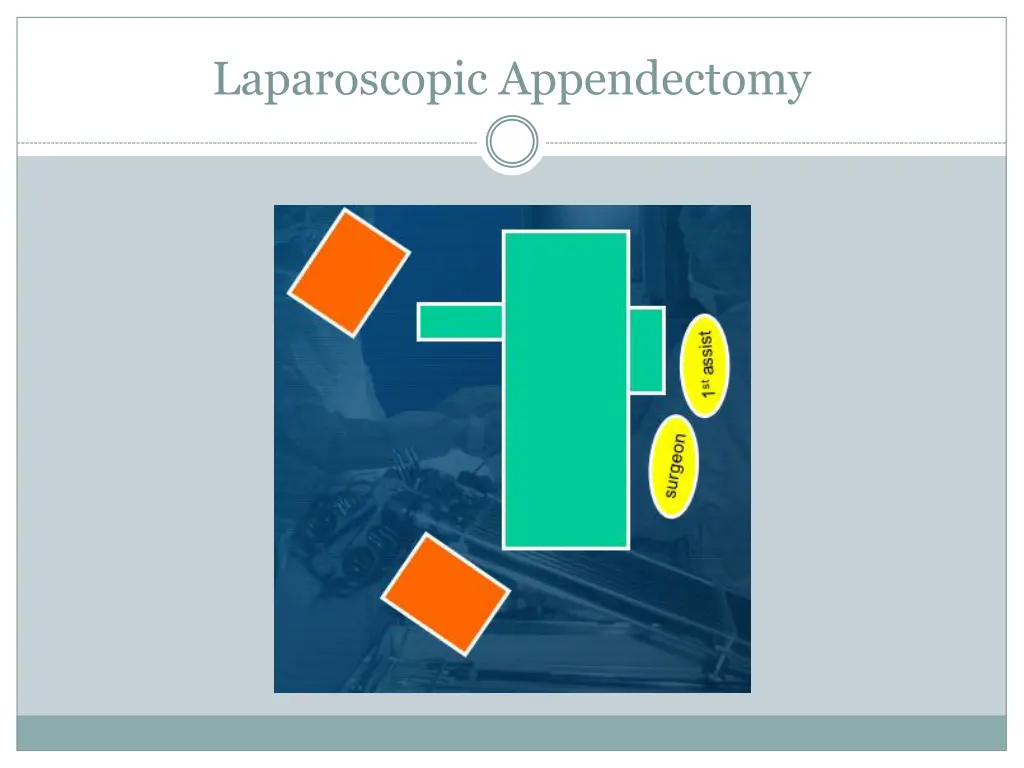 laparoscopic appendectomy