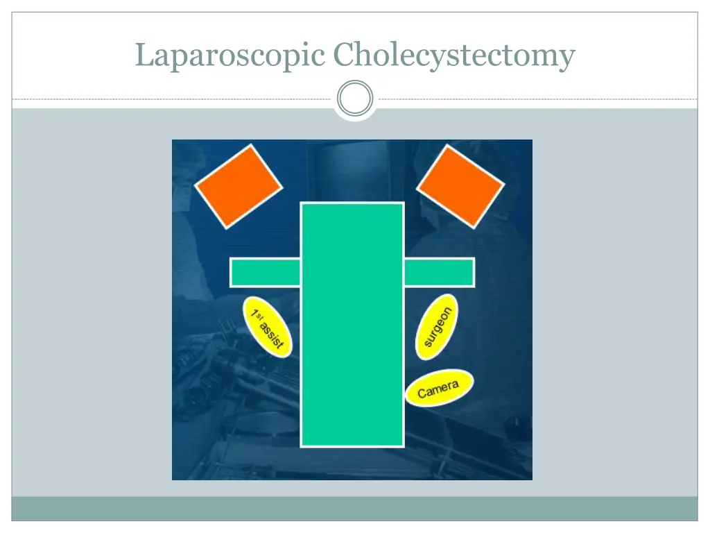 laparoscopic cholecystectomy