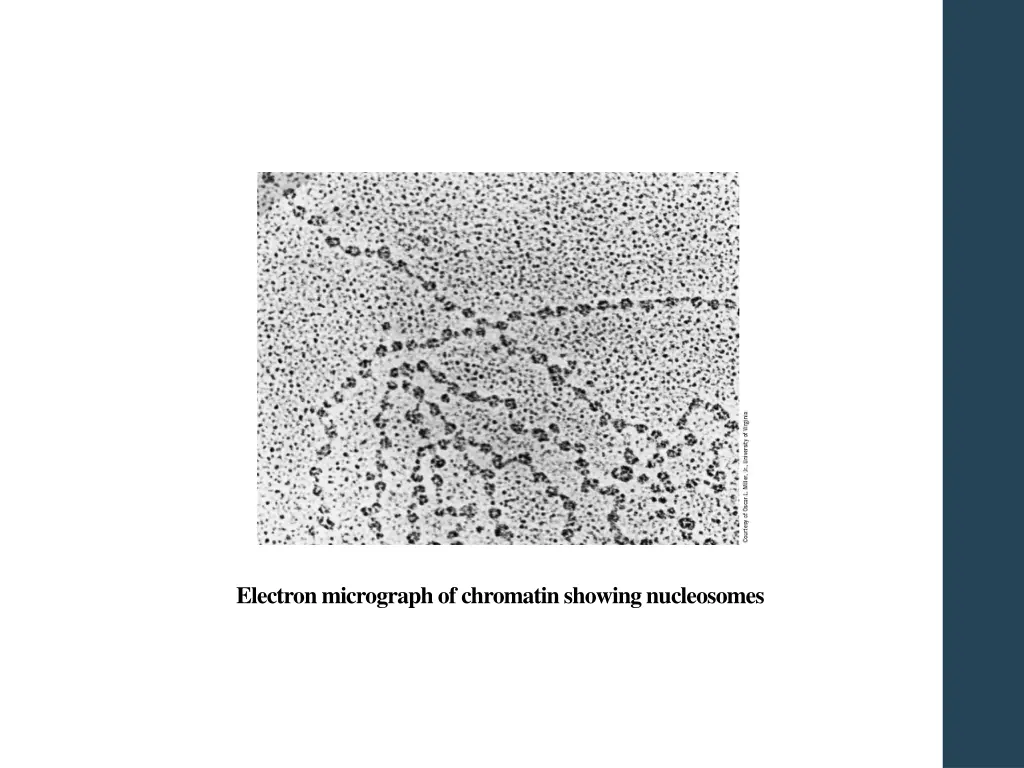 electron micrograph of chromatin showing