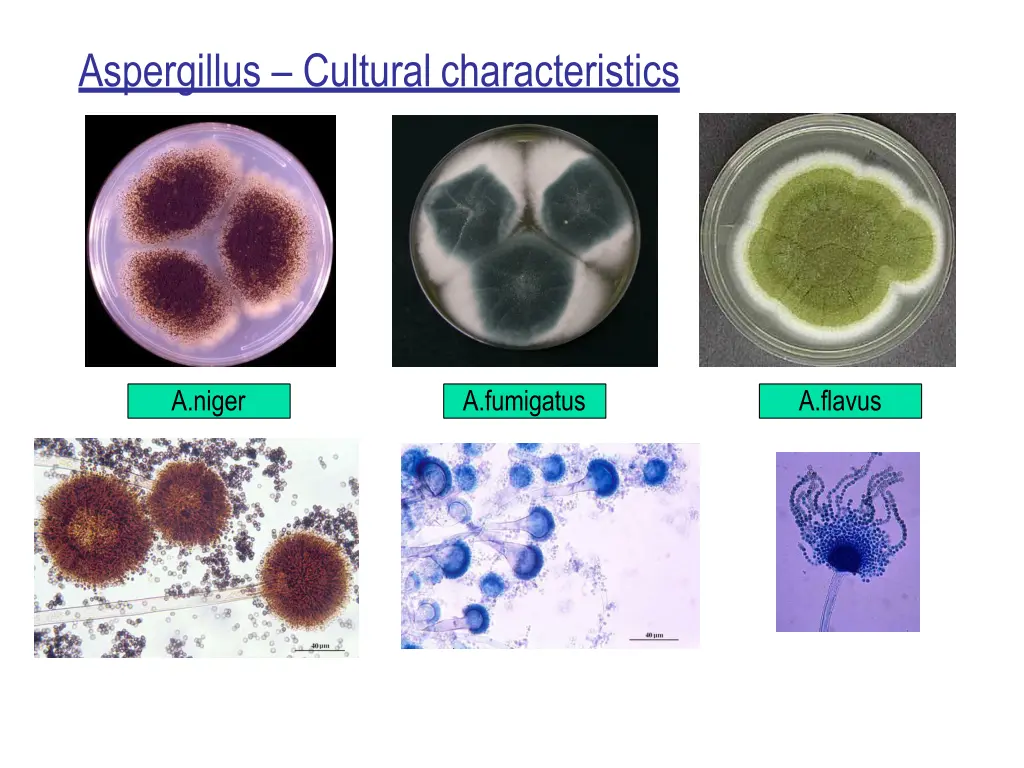 aspergillus culturalcharacteristics