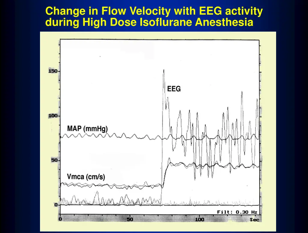 change in flow velocity with eeg activity during