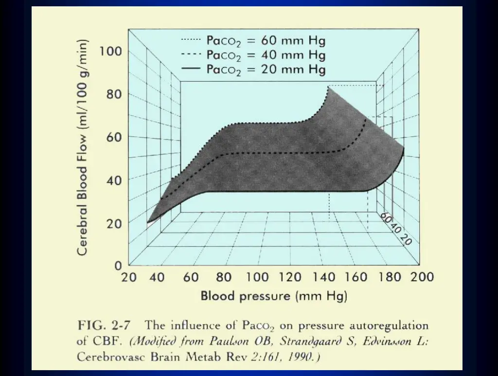 slide33