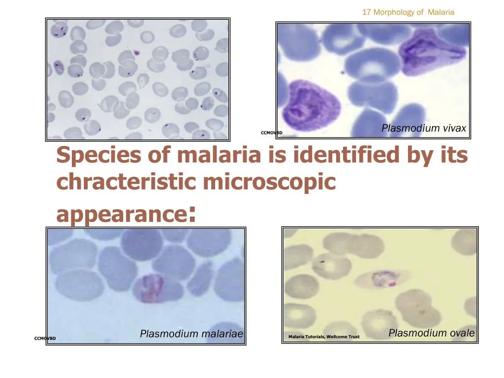 17 morphology of malaria