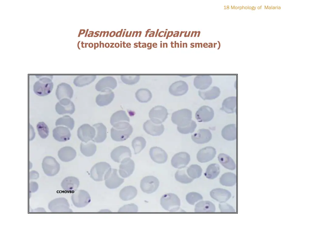 18 morphology of malaria