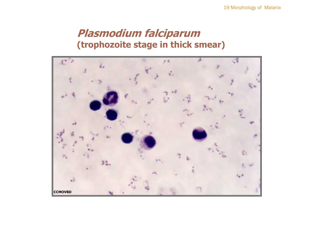 19 morphology of malaria