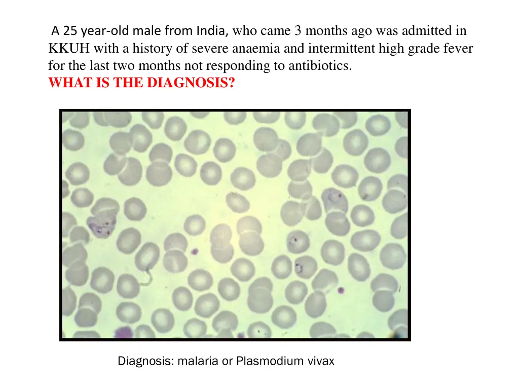 a 25 year old male from india who came 3 months