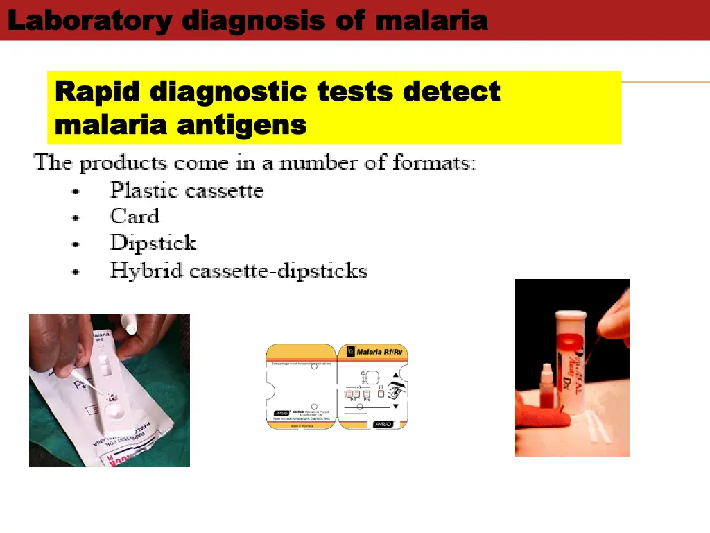 laboratory diagnosis of malaria laboratory