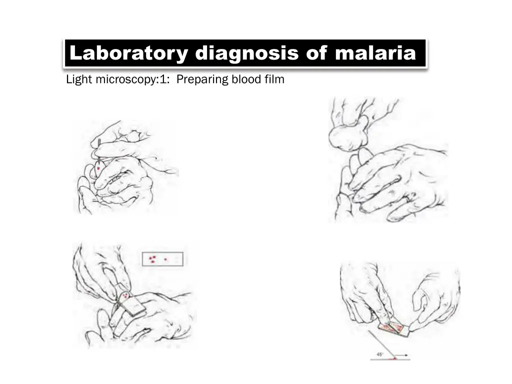 laboratory diagnosis of malaria light microscopy