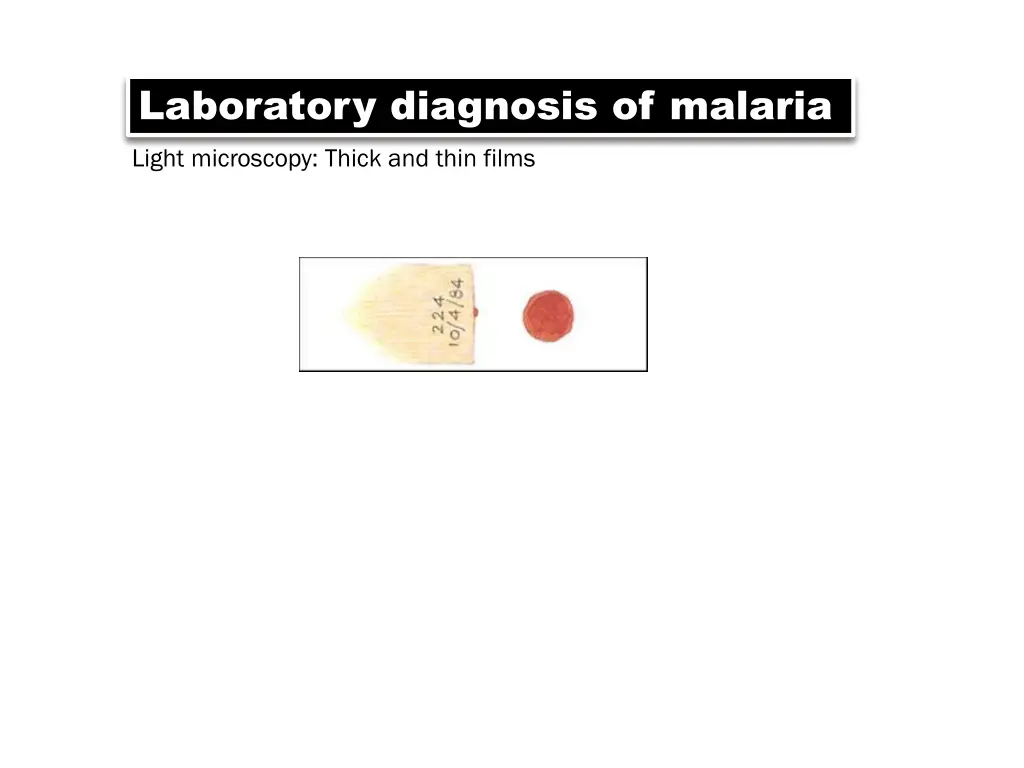 laboratory diagnosis of malaria