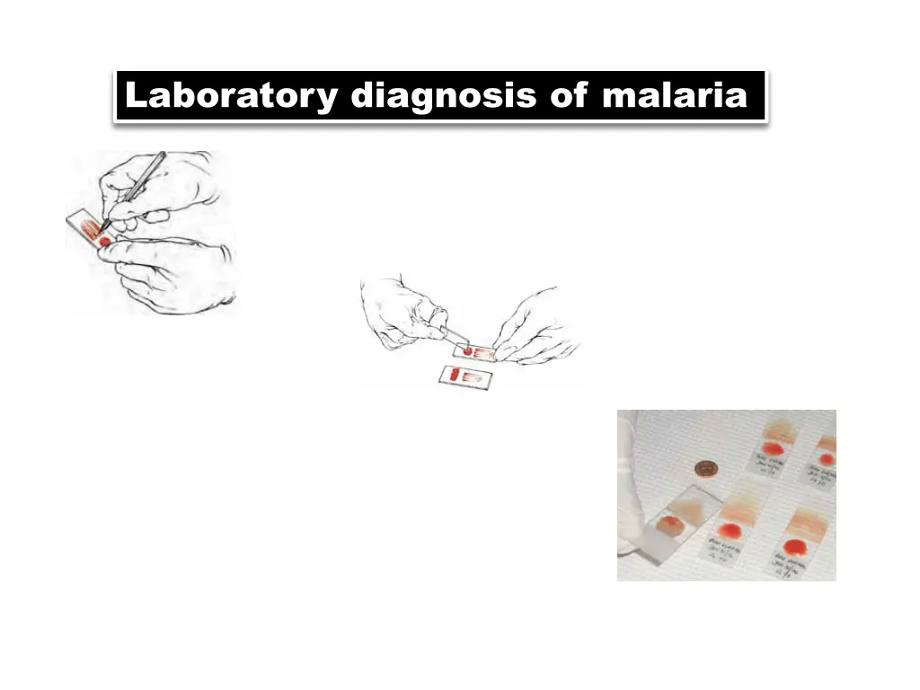 light microscopy 1 preparing blood film