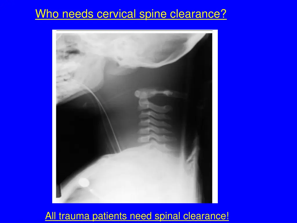 who needs cervical spine clearance