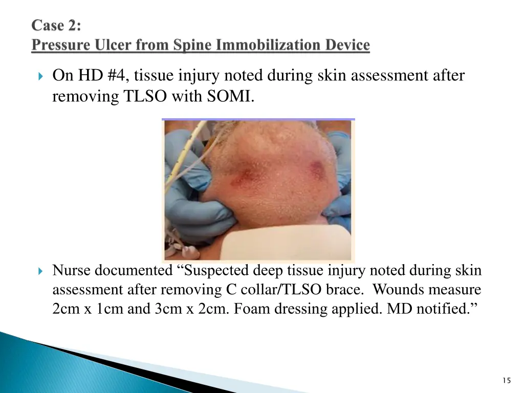 on hd 4 tissue injury noted during skin