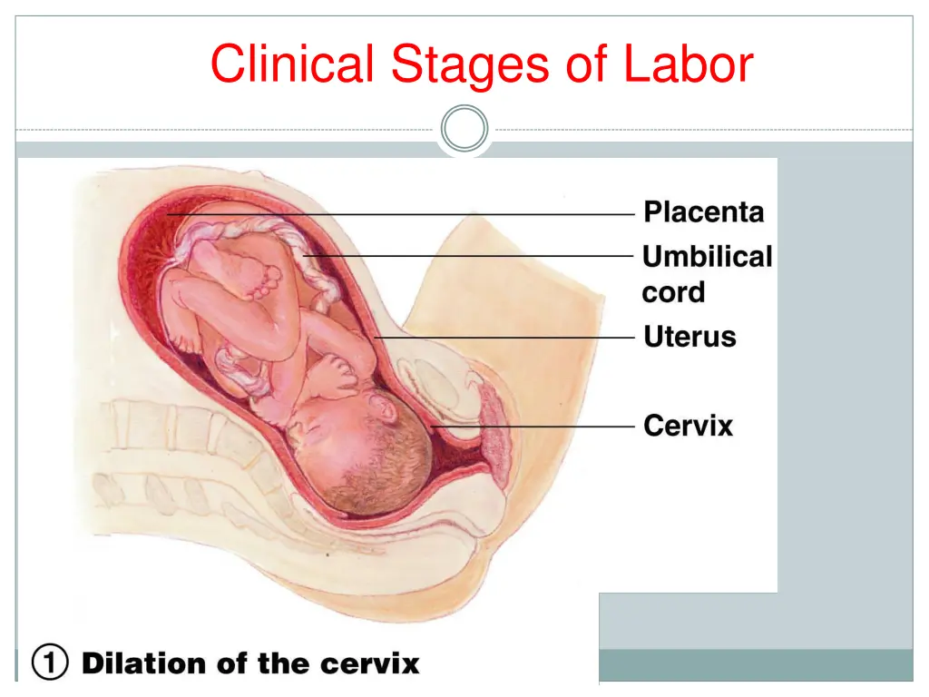 clinical stages of labor 2