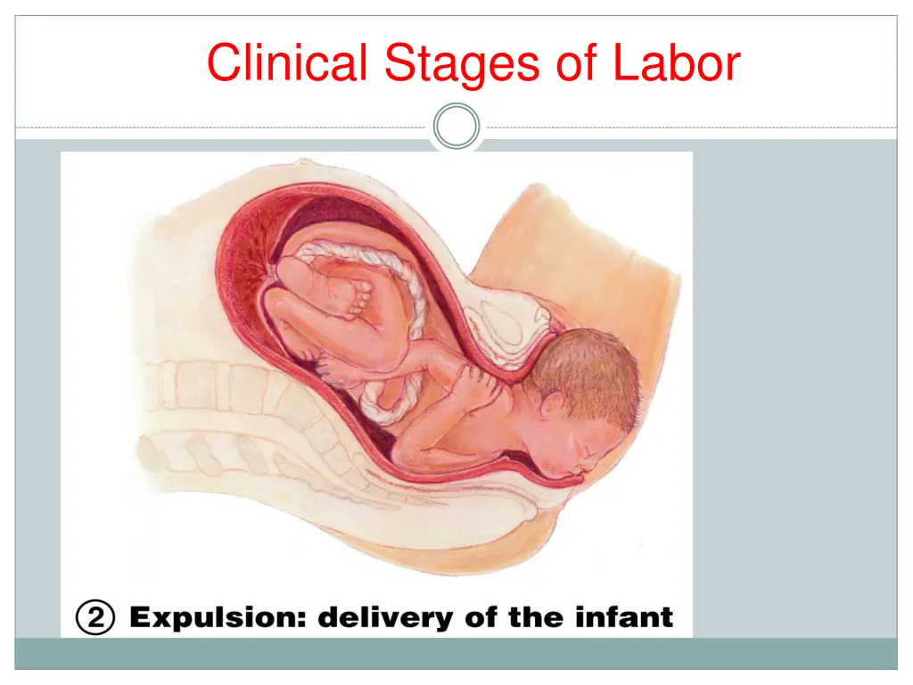 clinical stages of labor 3