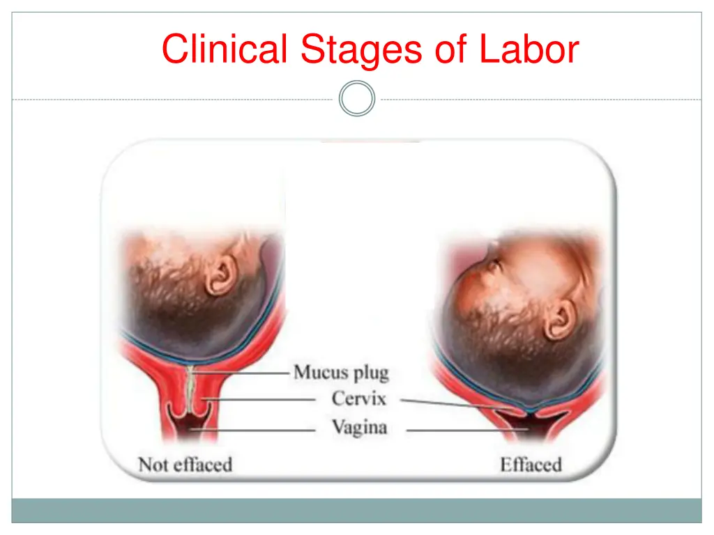 clinical stages of labor