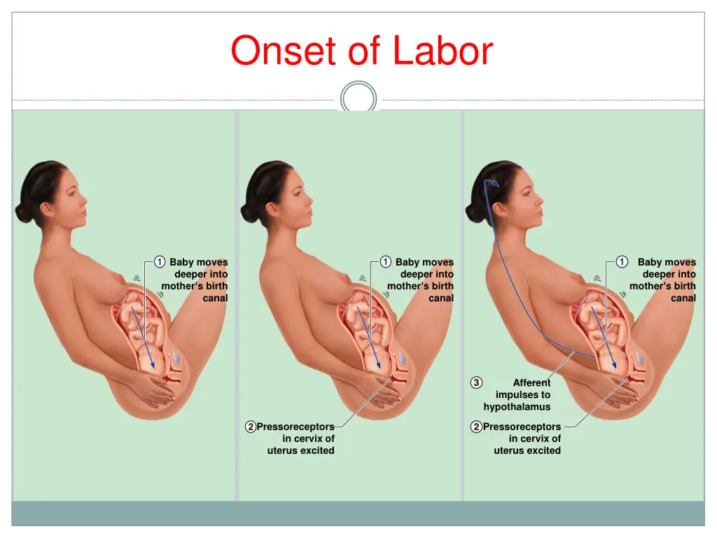 onset of labor 2