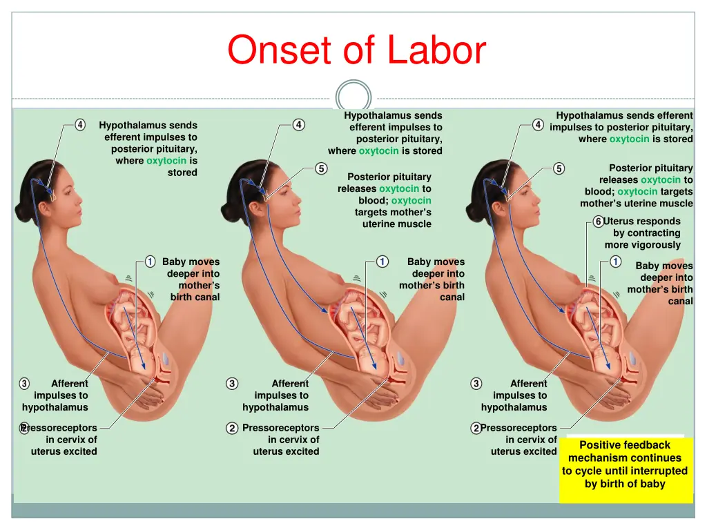 onset of labor 3