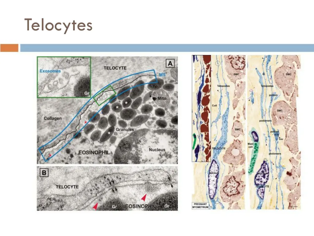 telocytes