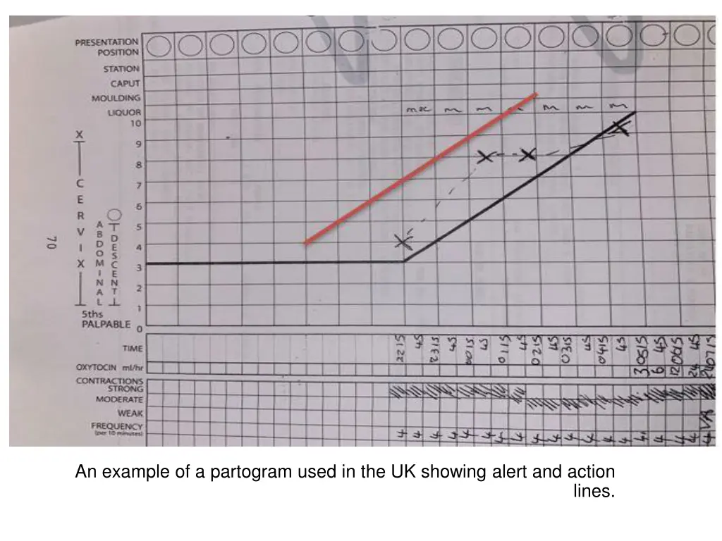 an example of a partogram used in the uk showing