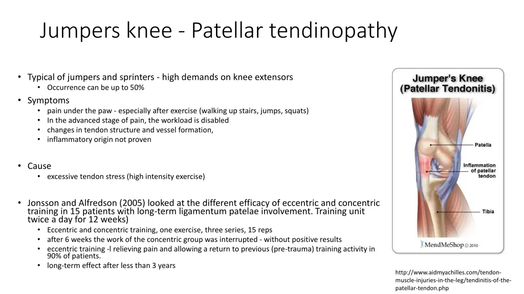 jumpers knee patellar tendinopathy