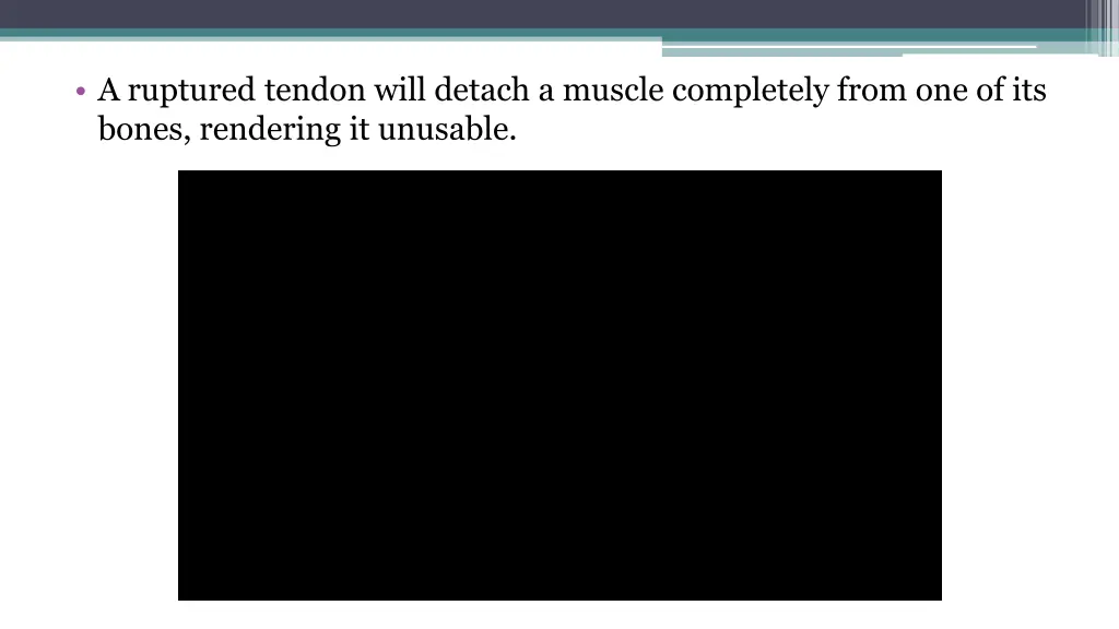 a ruptured tendon will detach a muscle completely