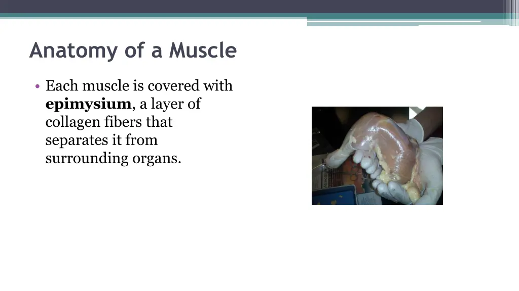 anatomy of a muscle