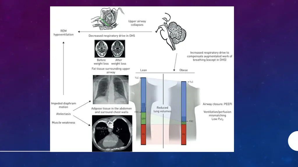 slide10