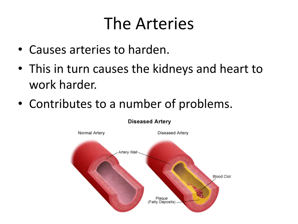 the arteries