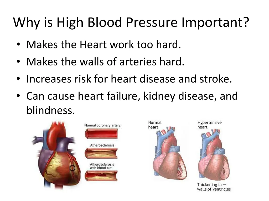 why is high blood pressure important