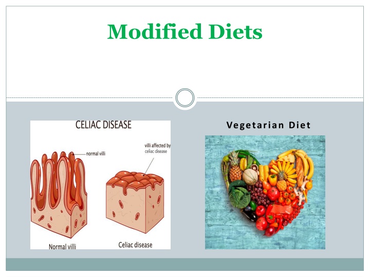 modified diets