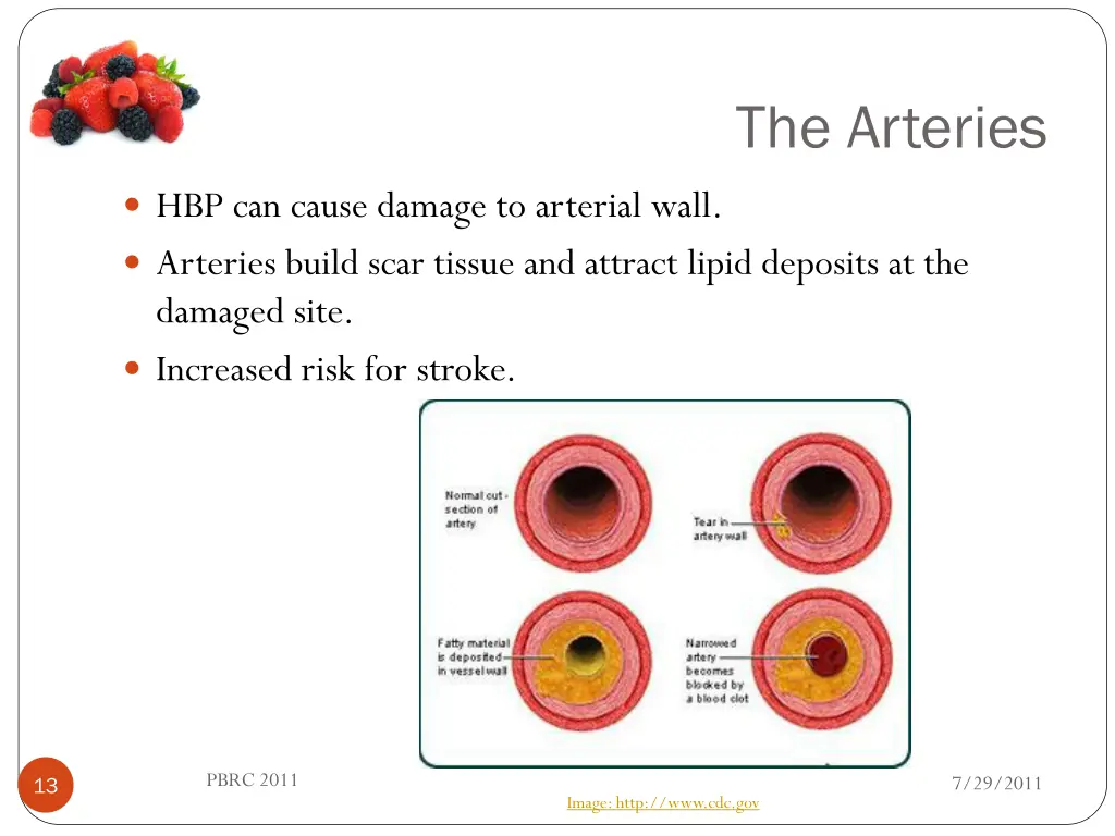 the arteries