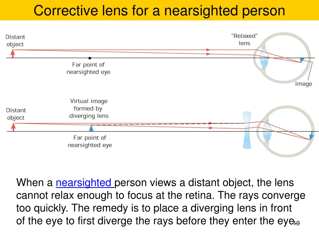 corrective lens for a nearsighted person