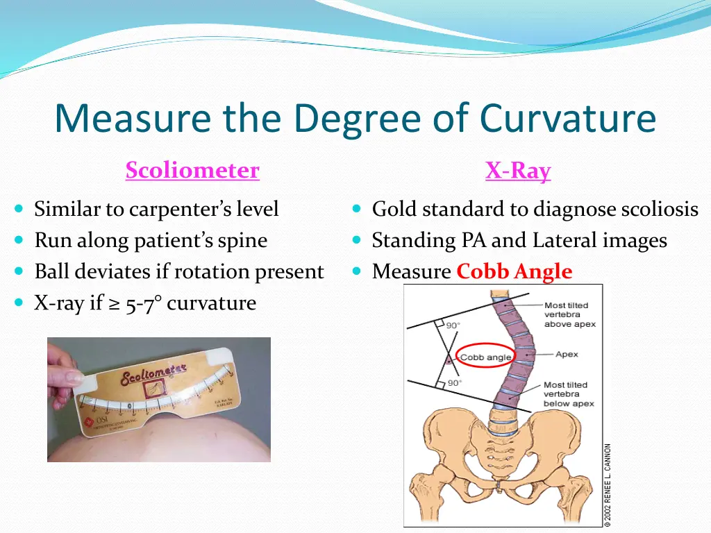 measure the degree of curvature