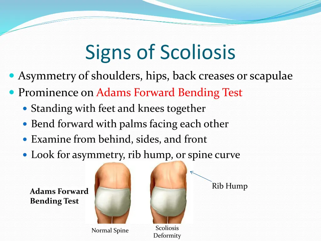 signs of scoliosis