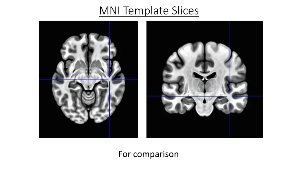 mni template slices