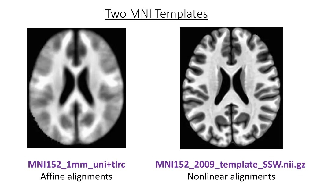 two mni templates