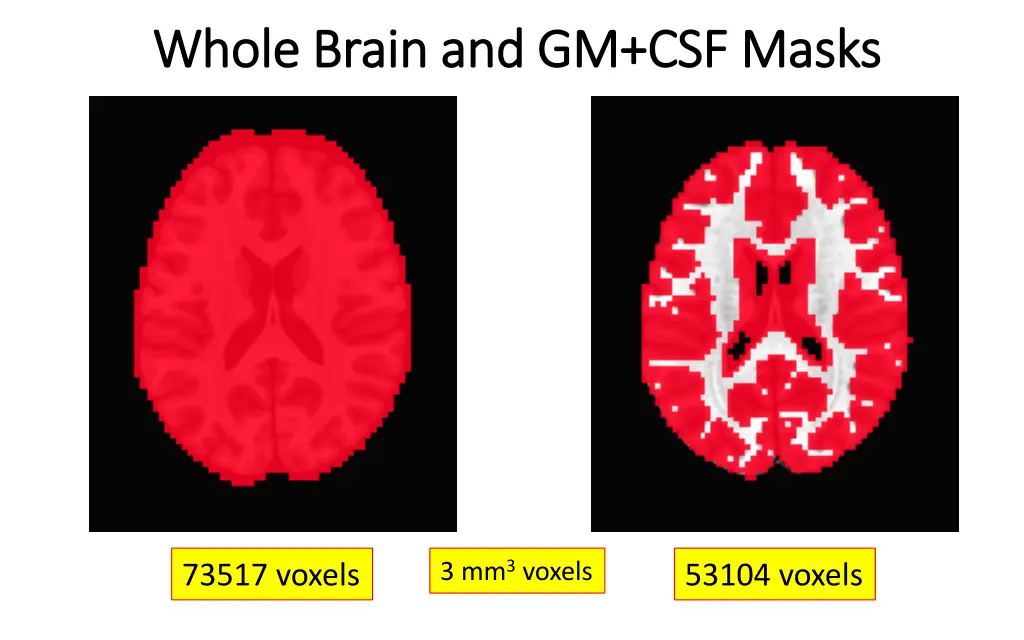 whole brain and gm csf masks whole brain