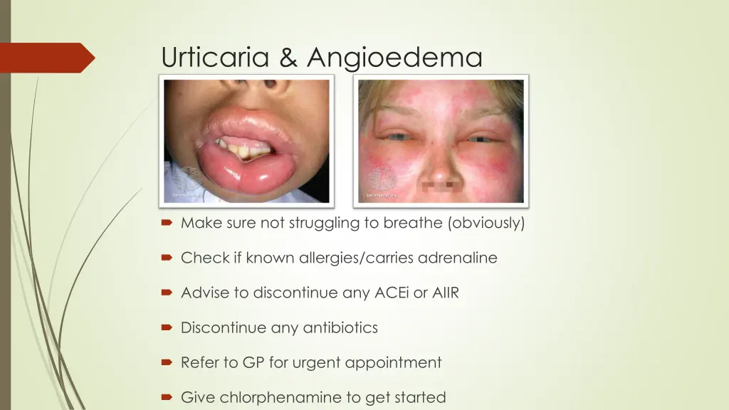 urticaria angioedema