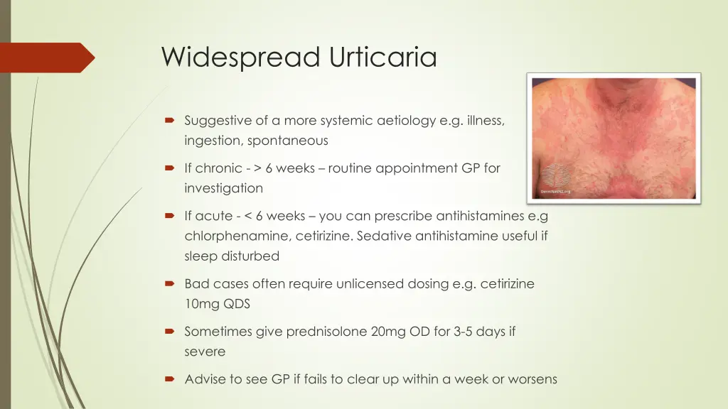 widespread urticaria