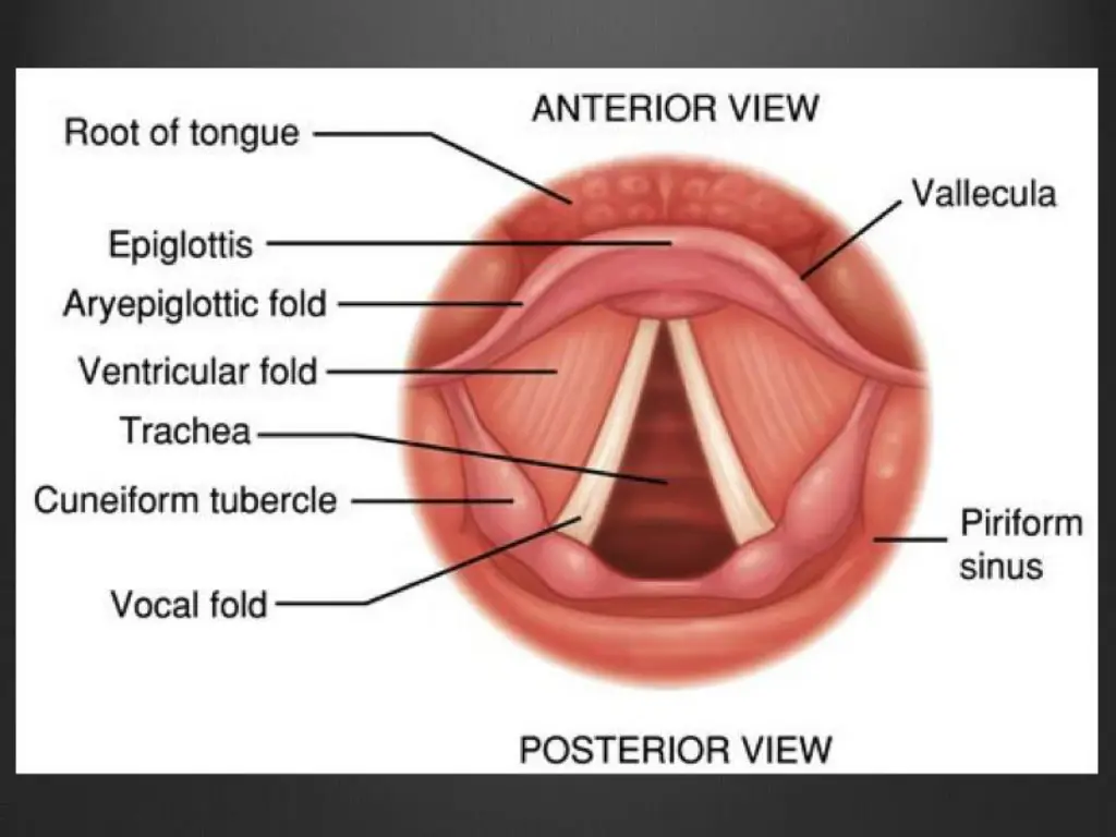 slide18