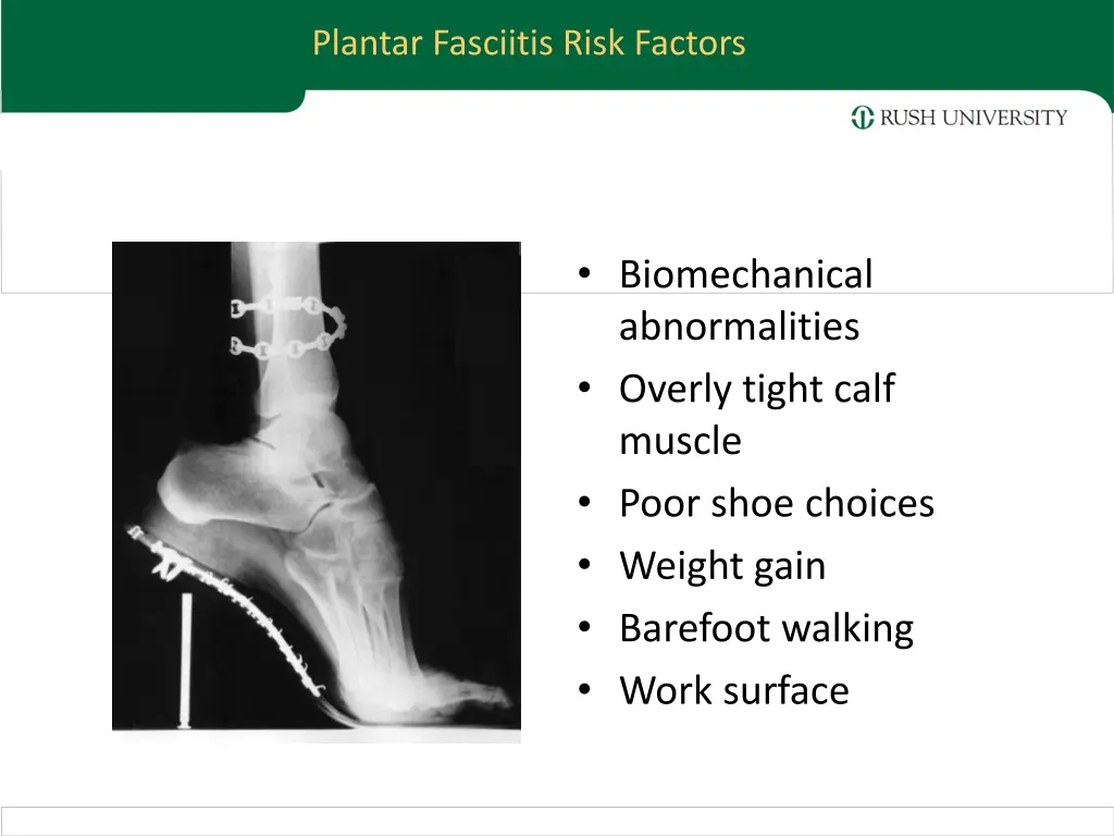 plantar fasciitis risk factors