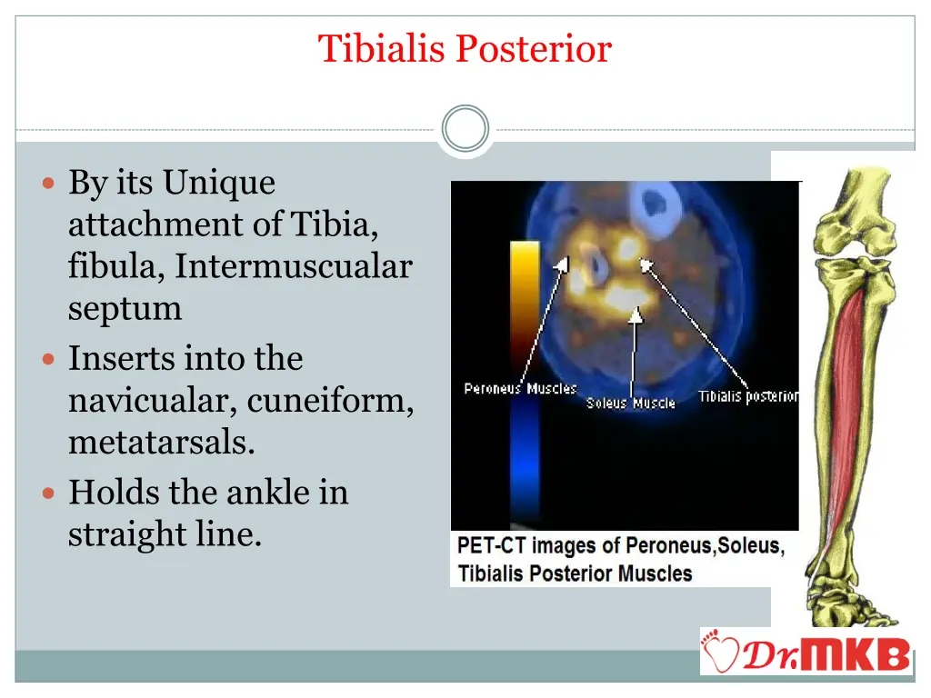 tibialis posterior