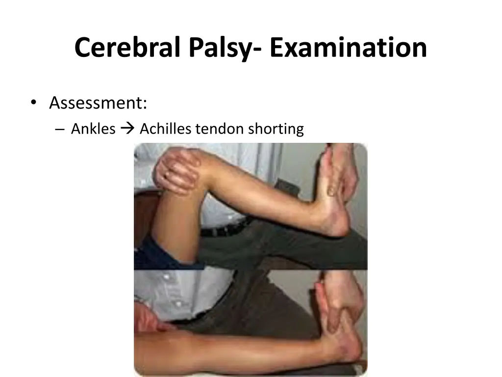 cerebral palsy examination 2