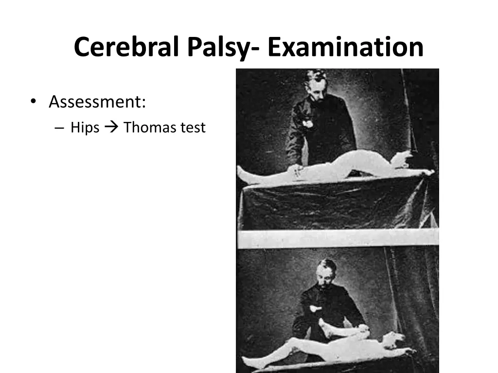 cerebral palsy examination