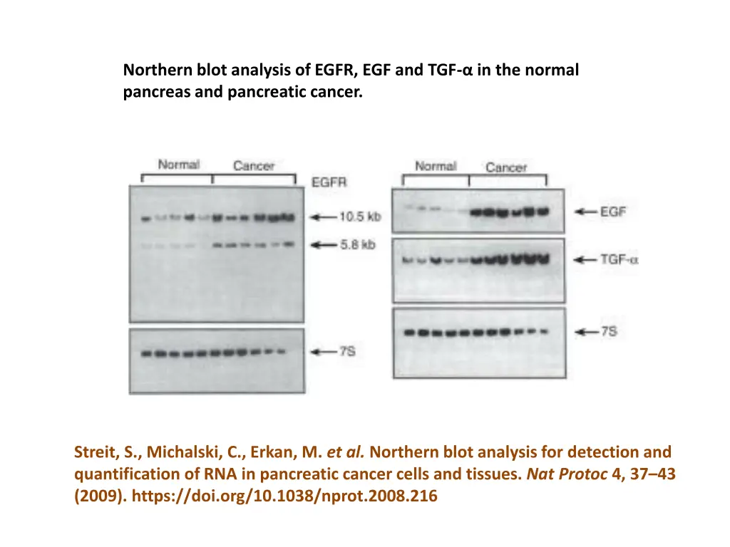 northern blot analysis of egfr