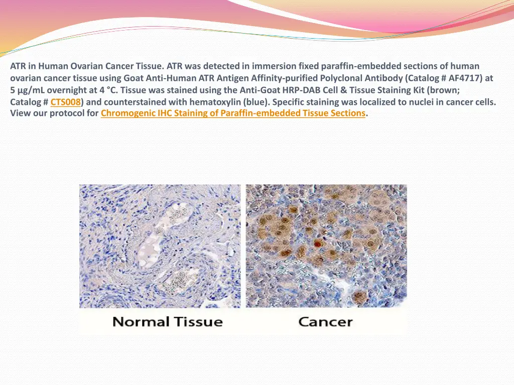 atr in human ovarian cancer tissue