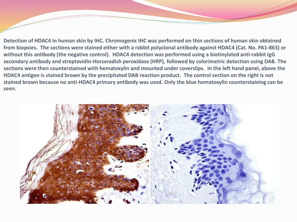 detection of hdac4 in human skin