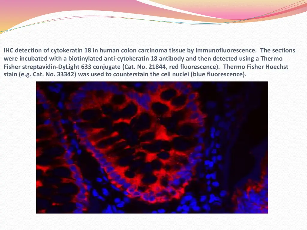 ihc detection of cytokeratin 18 in human colon